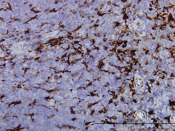 GSN Antibody in Immunohistochemistry (Paraffin) (IHC (P))