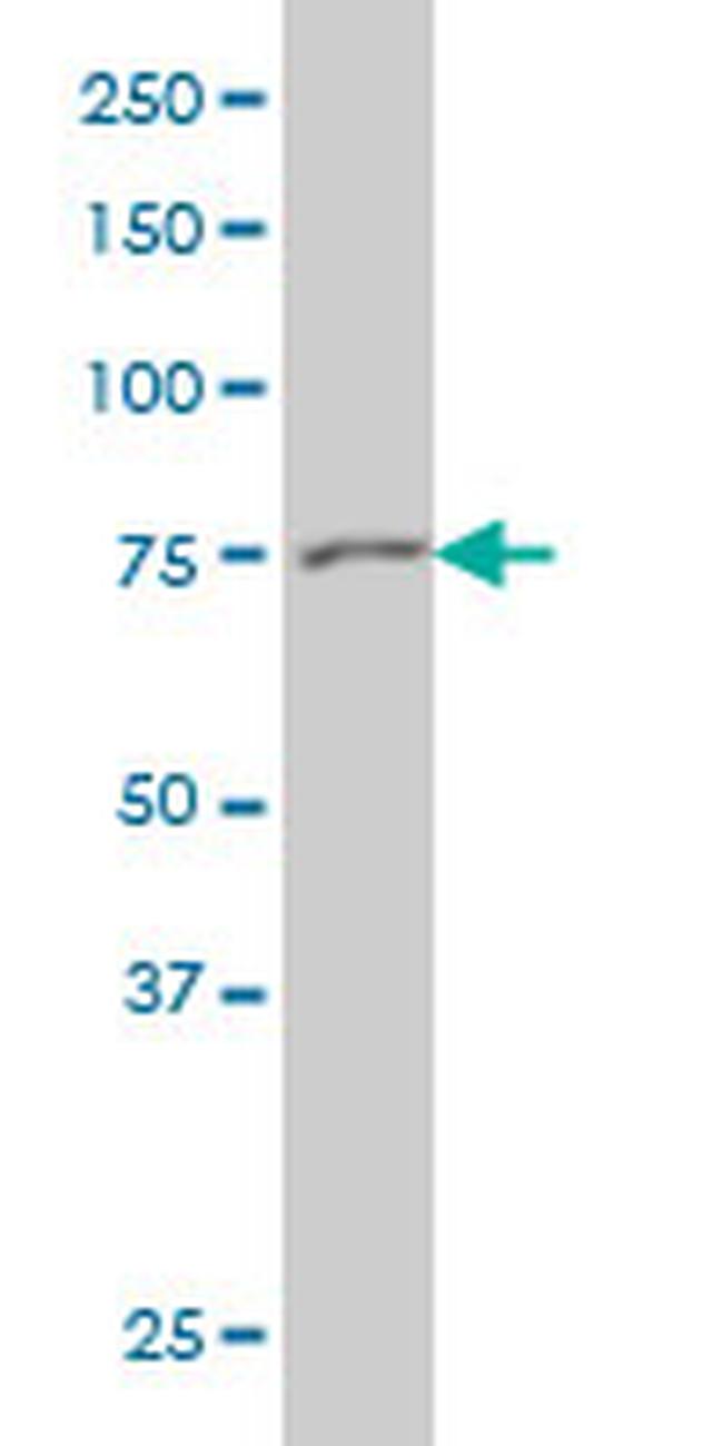 GSN Antibody in Western Blot (WB)