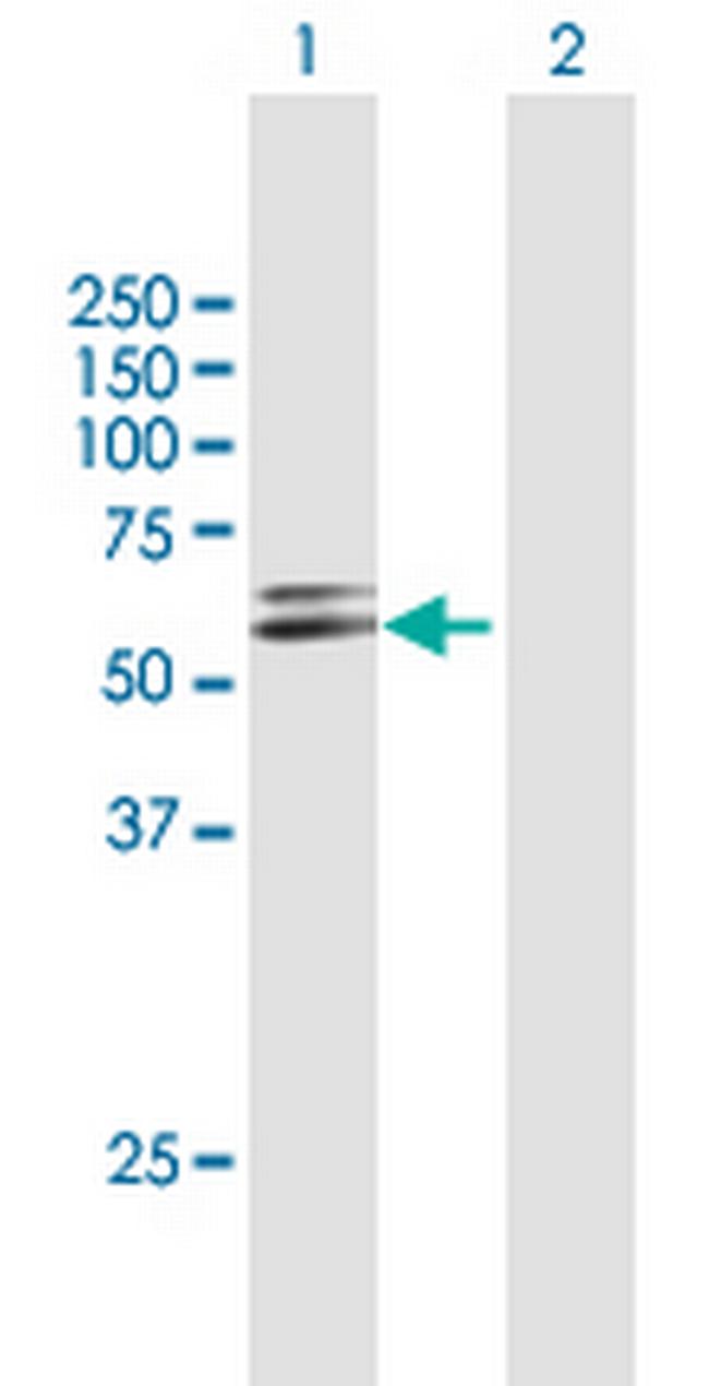 GSR Antibody in Western Blot (WB)