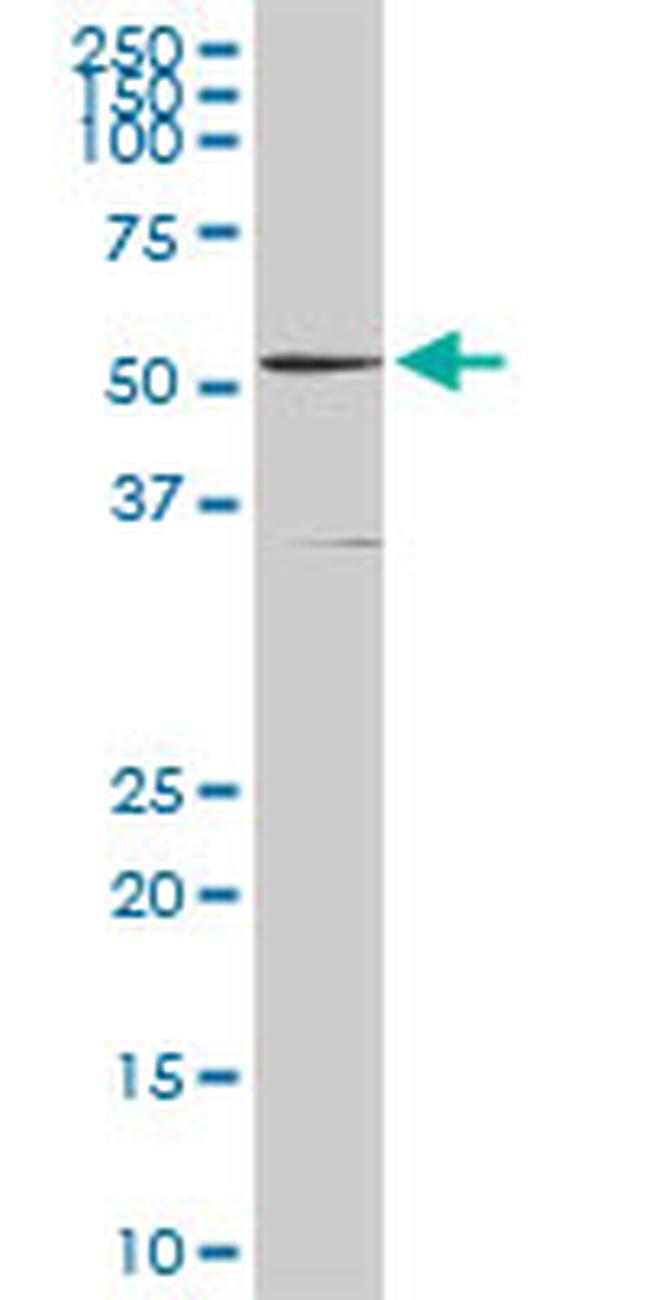 GSR Antibody in Western Blot (WB)