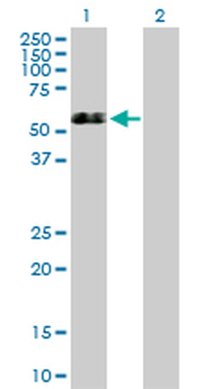 GSR Antibody in Western Blot (WB)