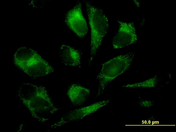 GSTM2 Antibody in Immunocytochemistry (ICC/IF)