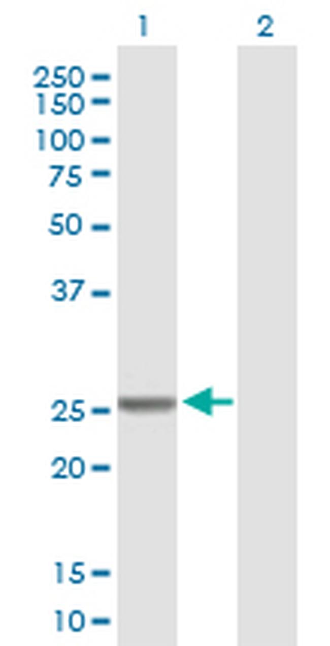 GSTM4 Antibody in Western Blot (WB)