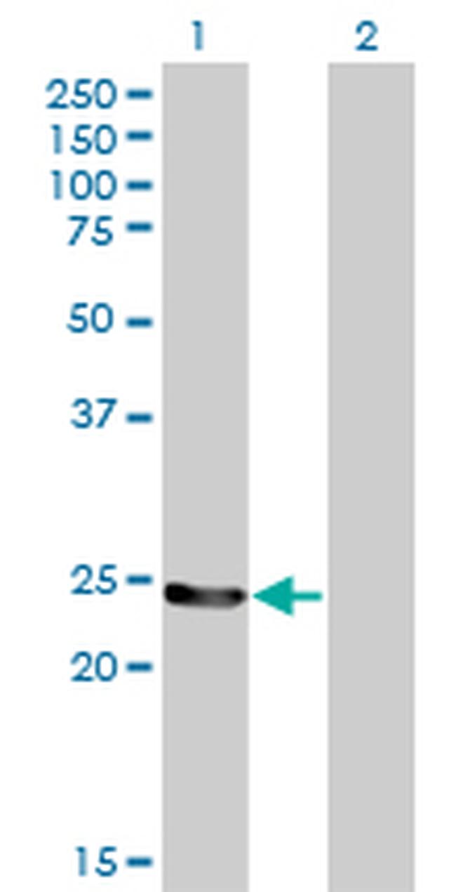 GSTM4 Antibody in Western Blot (WB)