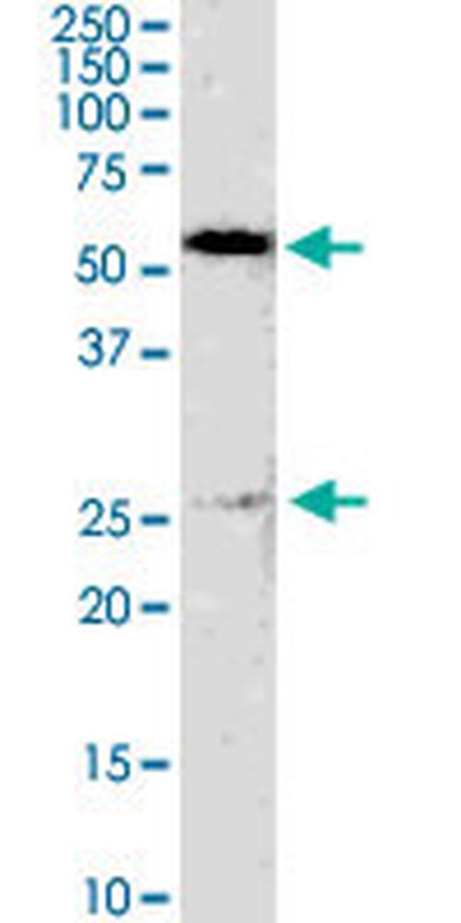 GSTM4 Antibody in Western Blot (WB)