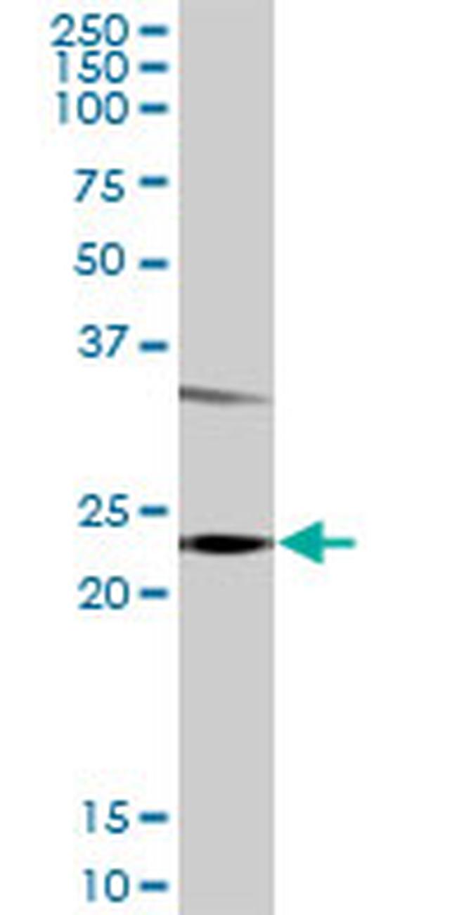 GSTP1 Antibody in Western Blot (WB)