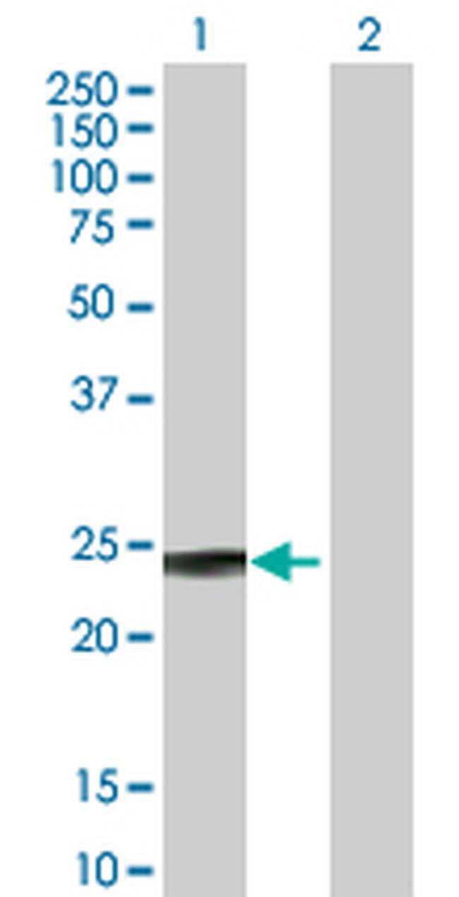 GSTP1 Antibody in Western Blot (WB)