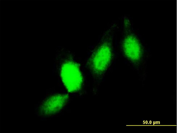 GSTP1 Antibody in Immunocytochemistry (ICC/IF)