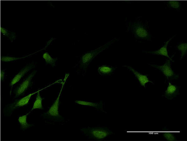 GSTP1 Antibody in Immunocytochemistry (ICC/IF)