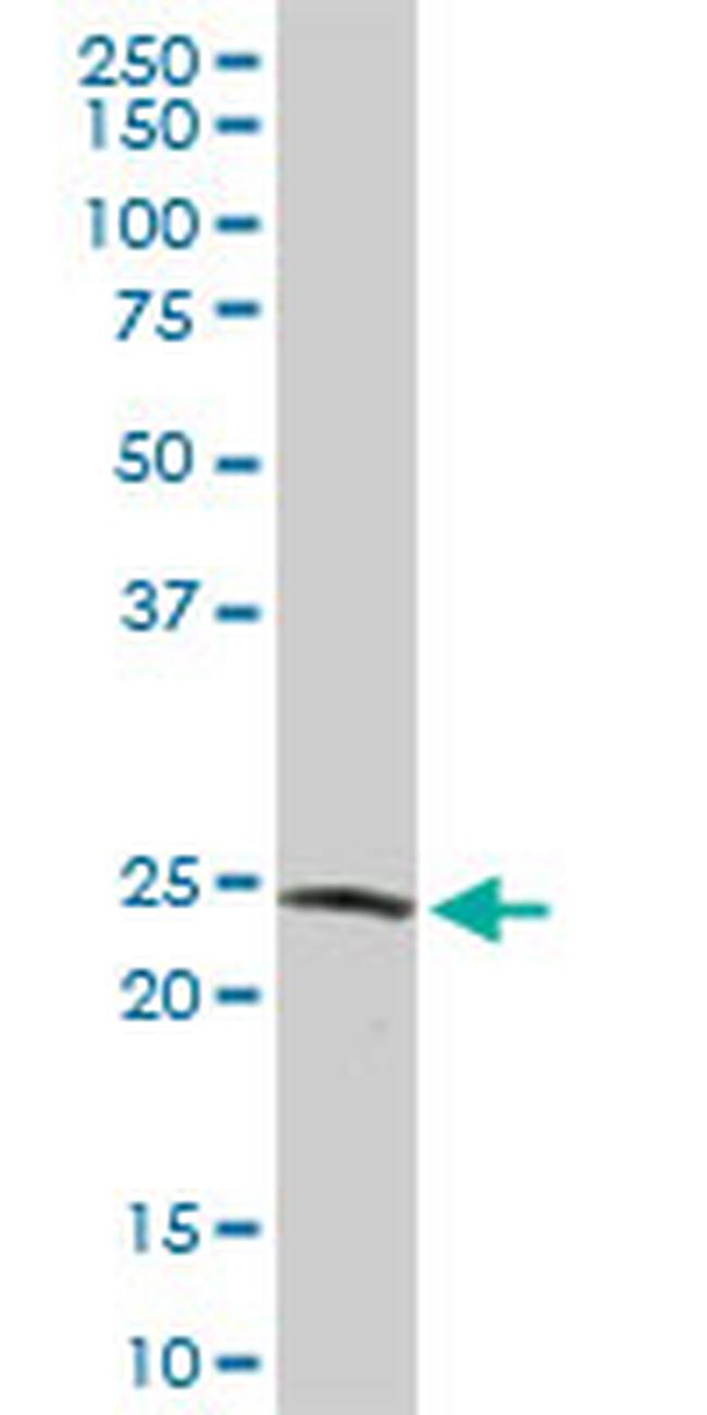 GSTZ1 Antibody in Western Blot (WB)