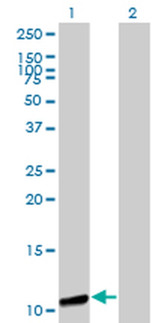 GTF2A2 Antibody in Western Blot (WB)