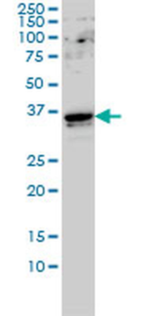 GTF2E2 Antibody in Western Blot (WB)