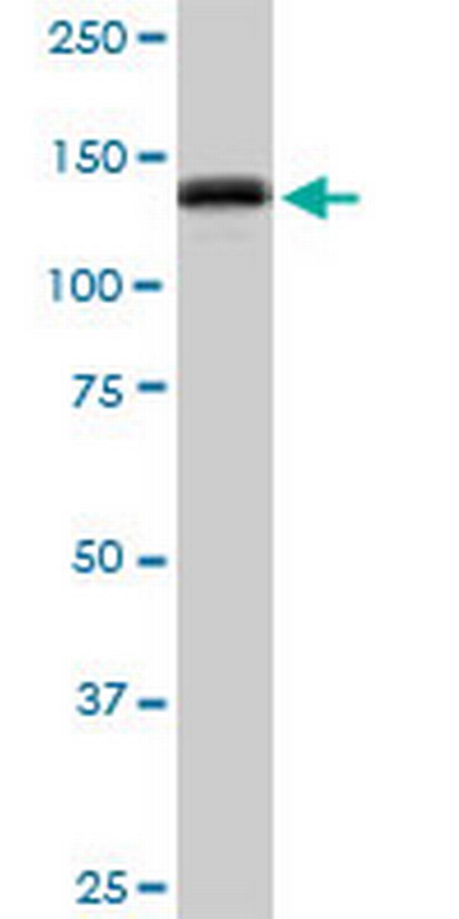 GTF2I Antibody in Western Blot (WB)