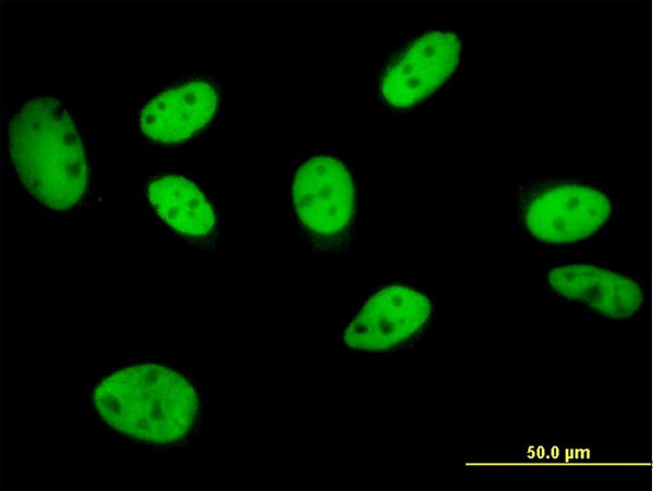 GTF2I Antibody in Immunocytochemistry (ICC/IF)