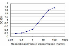 GTF2I Antibody in ELISA (ELISA)