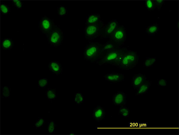 GTF2I Antibody in Immunocytochemistry (ICC/IF)