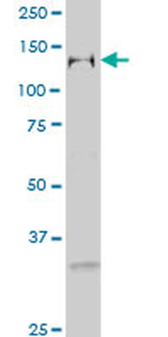 GTF2I Antibody in Western Blot (WB)