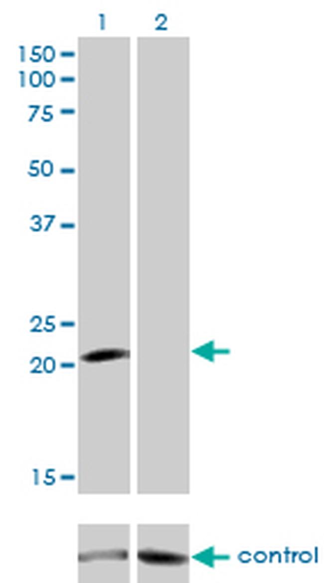 GUCA1A Antibody in Western Blot (WB)