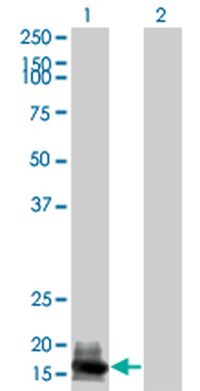 GUCA1A Antibody in Western Blot (WB)