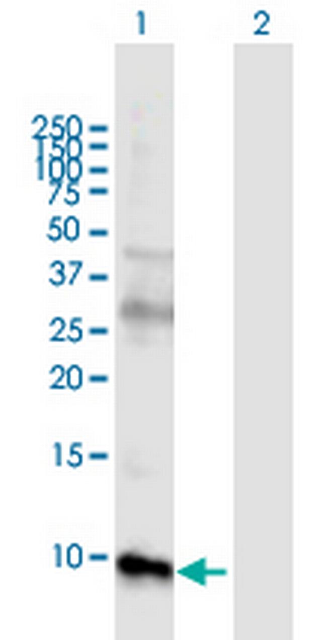 GUCA2B Antibody in Western Blot (WB)