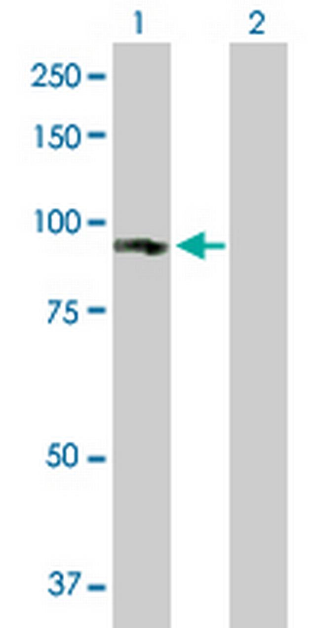 GUCY1A3 Antibody in Western Blot (WB)