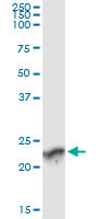 GUK1 Antibody in Immunoprecipitation (IP)