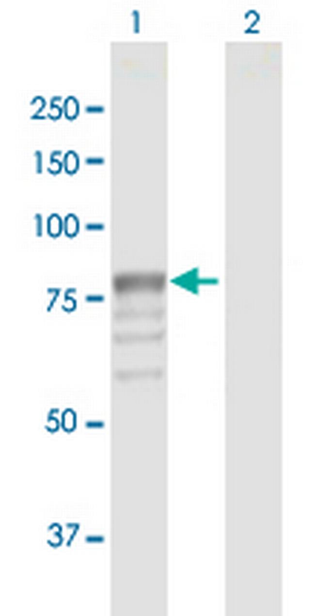 GUSB Antibody in Western Blot (WB)