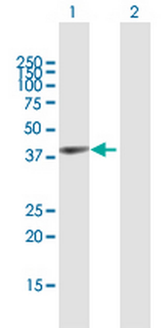 GYG1 Antibody in Western Blot (WB)