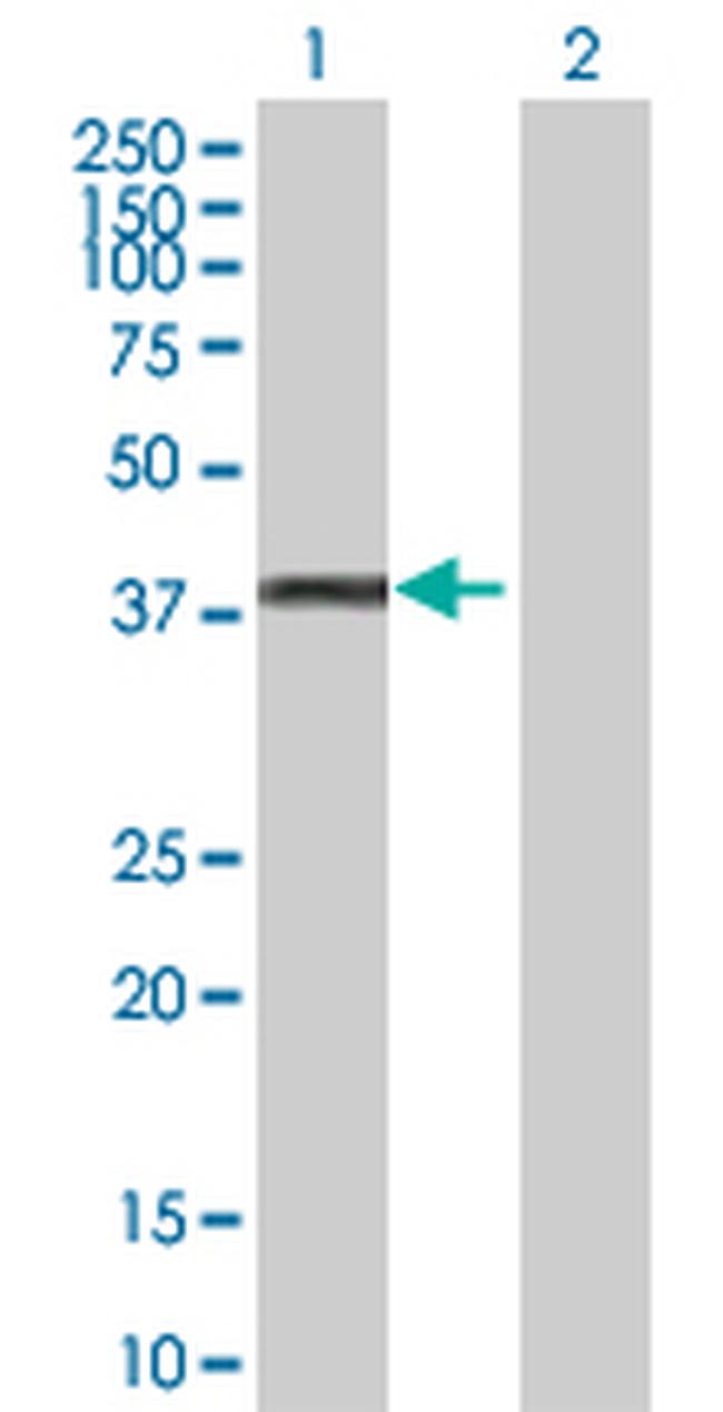 GYG1 Antibody in Western Blot (WB)