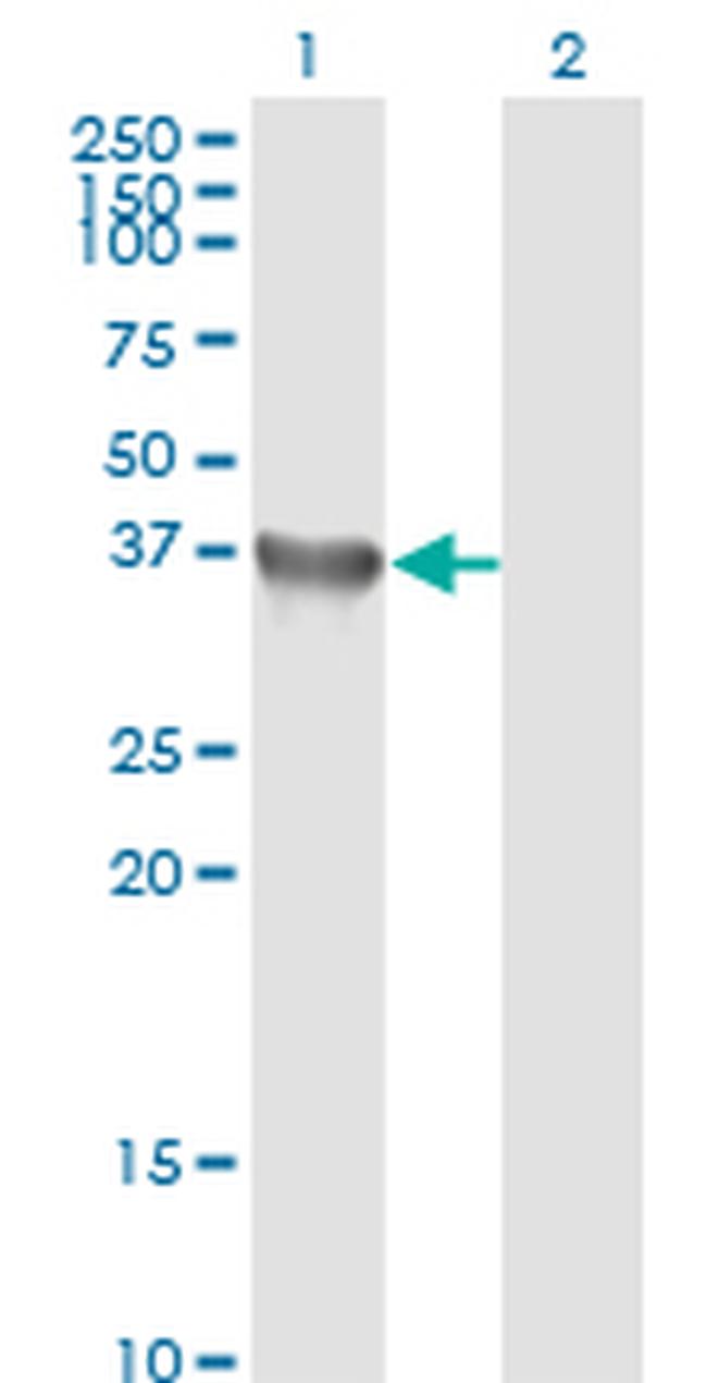 GYG1 Antibody in Western Blot (WB)