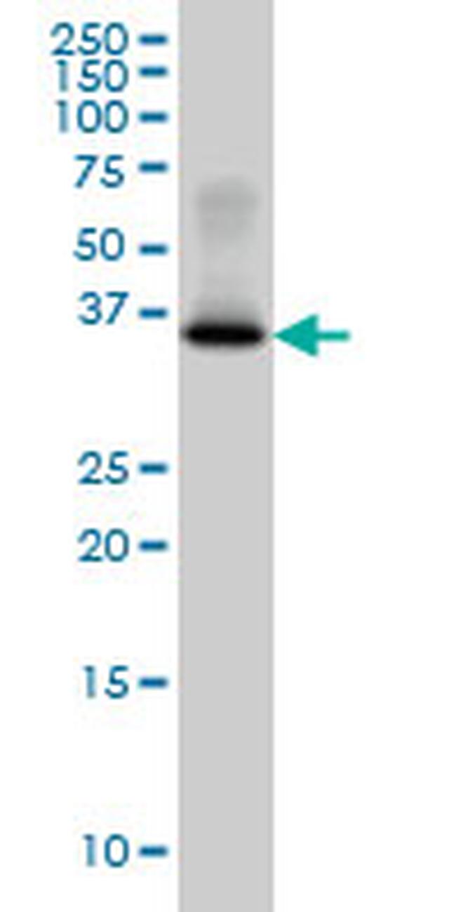 GYG1 Antibody in Western Blot (WB)