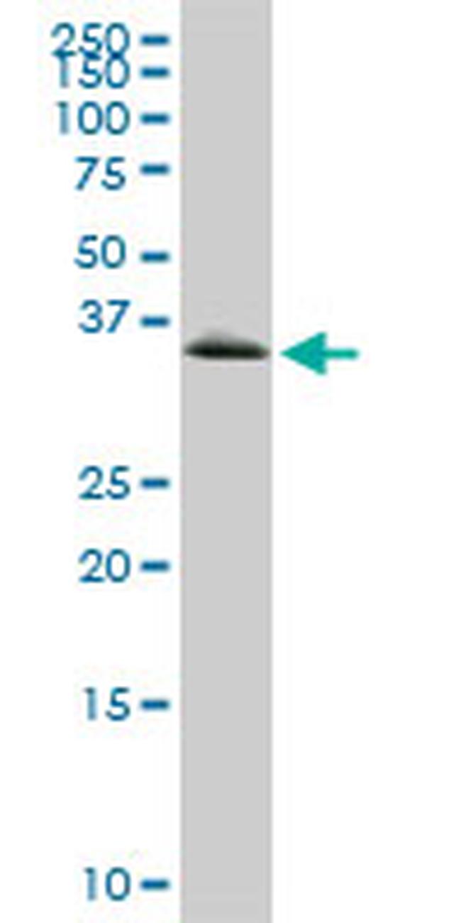 GYG1 Antibody in Western Blot (WB)