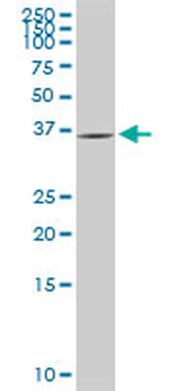 GYG1 Antibody in Western Blot (WB)