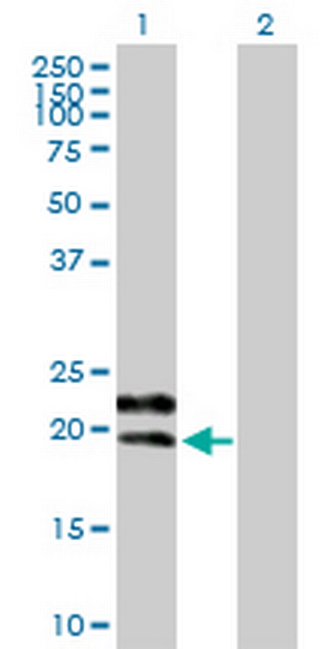 GYPC Antibody in Western Blot (WB)