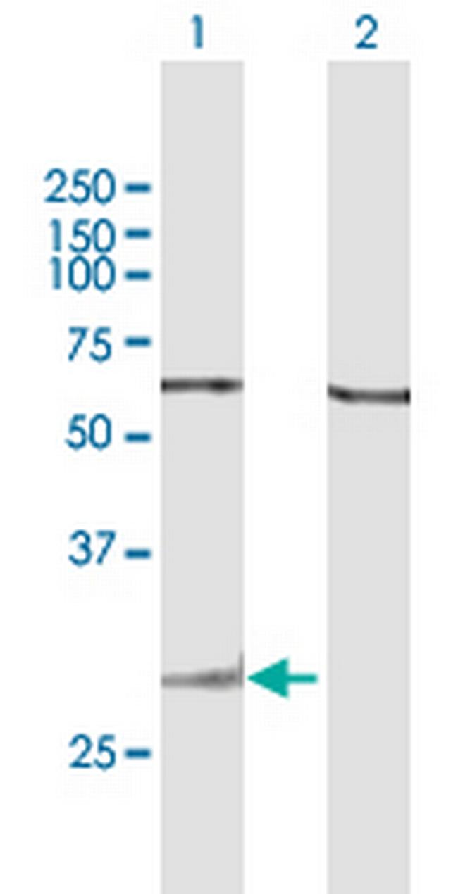 GZMK Antibody in Western Blot (WB)