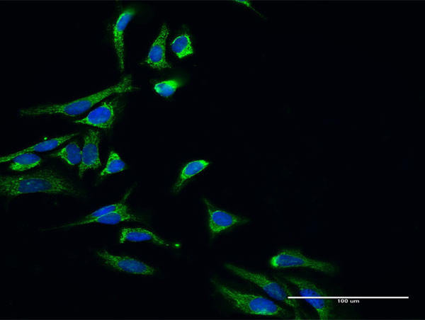 HSD17B10 Antibody in Immunocytochemistry (ICC/IF)