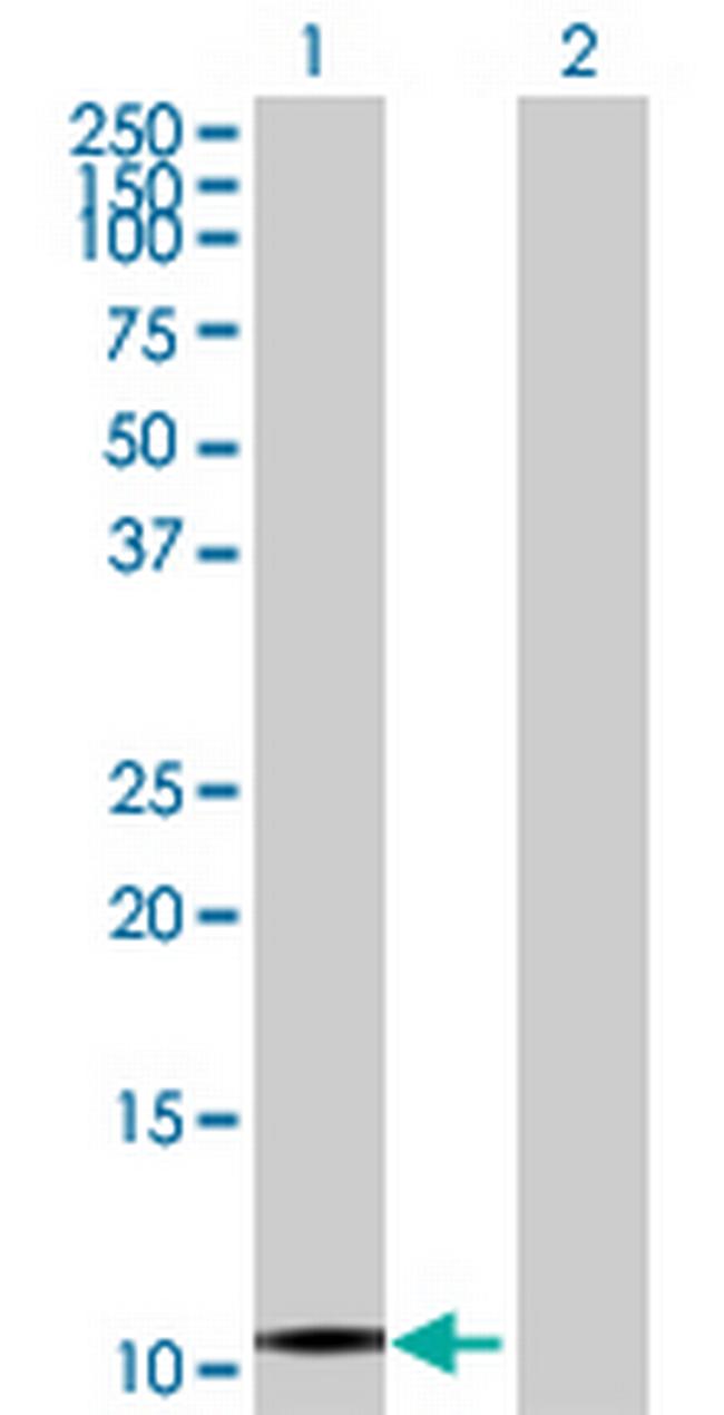 HBZ Antibody in Western Blot (WB)