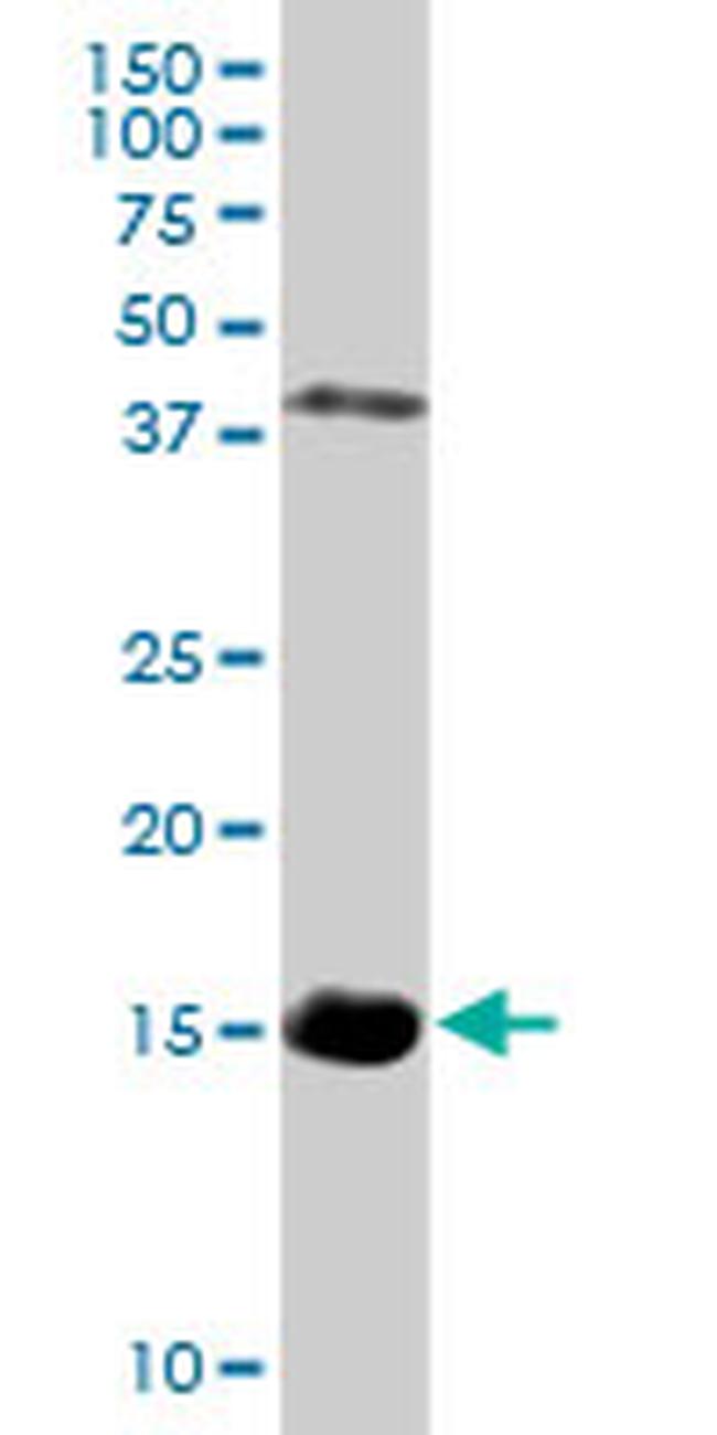 HBZ Antibody in Western Blot (WB)