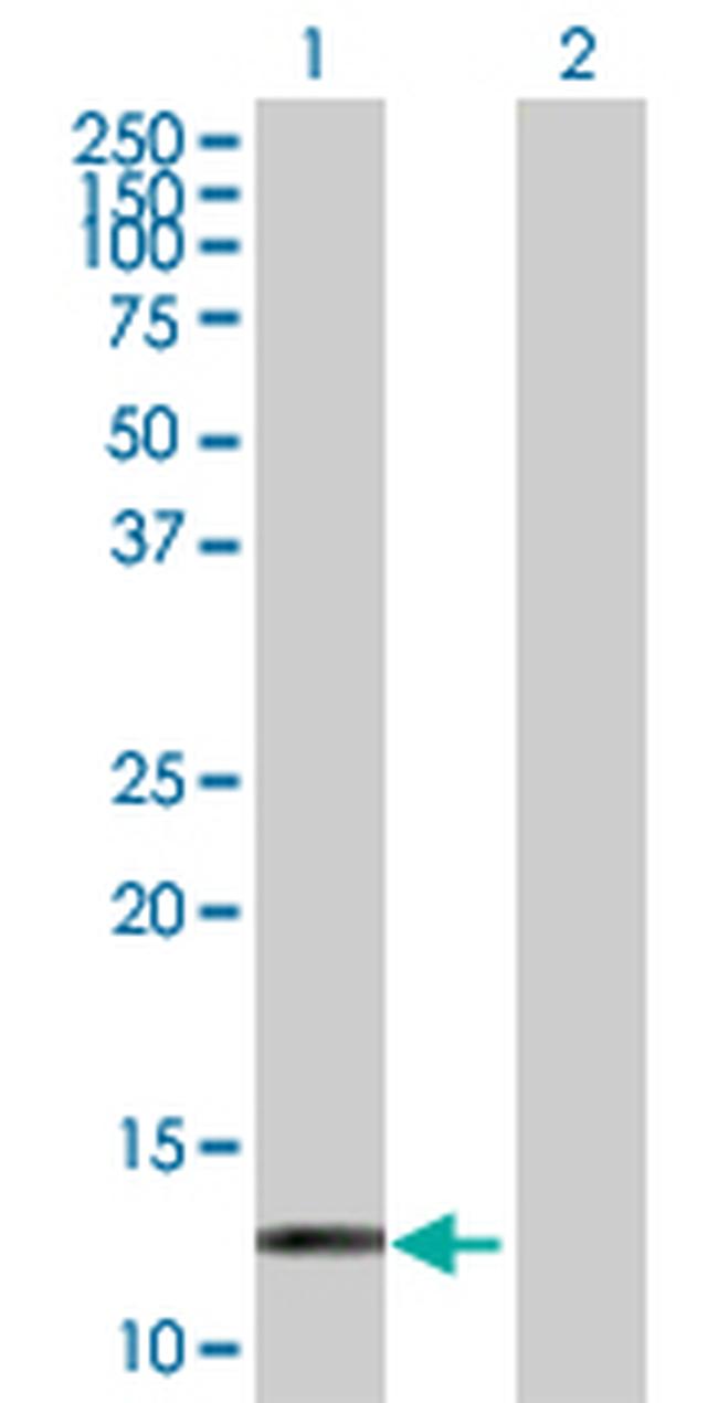 HBZ Antibody in Western Blot (WB)