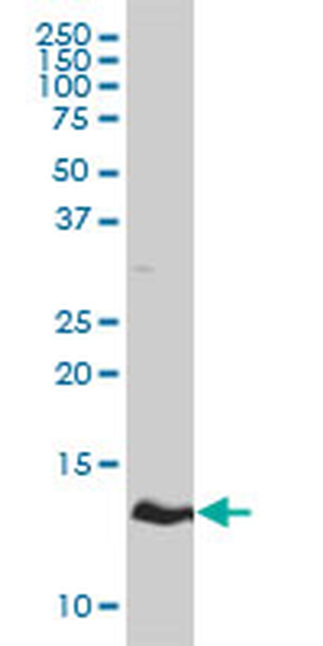 HBZ Antibody in Western Blot (WB)