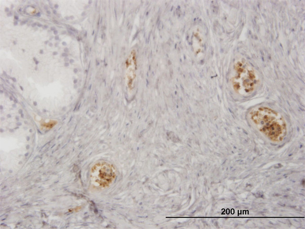 HBZ Antibody in Immunohistochemistry (Paraffin) (IHC (P))