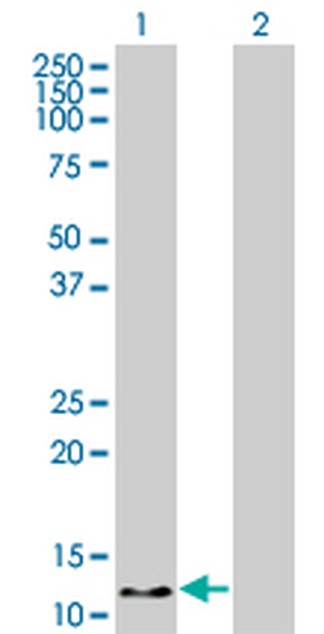 HBZ Antibody in Western Blot (WB)