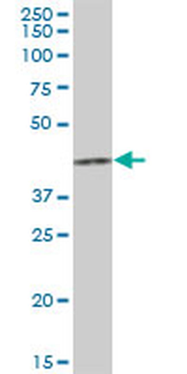 HCCS Antibody in Western Blot (WB)