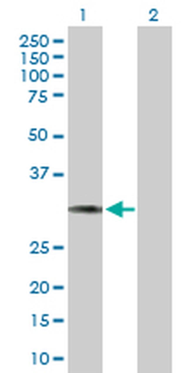 HCCS Antibody in Western Blot (WB)