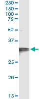 HCCS Antibody in Immunoprecipitation (IP)