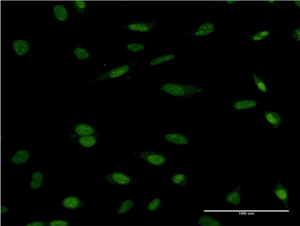 HCLS1 Antibody in Immunocytochemistry (ICC/IF)