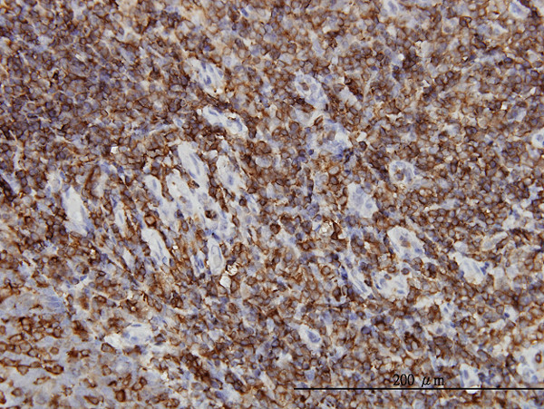 HCLS1 Antibody in Immunohistochemistry (Paraffin) (IHC (P))