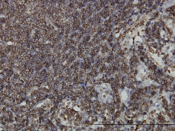 HCLS1 Antibody in Immunohistochemistry (Paraffin) (IHC (P))