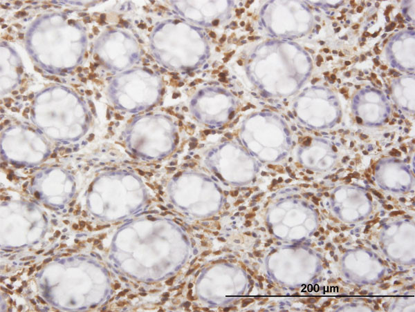 HCLS1 Antibody in Immunohistochemistry (Paraffin) (IHC (P))