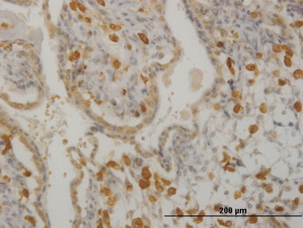 HCLS1 Antibody in Immunohistochemistry (Paraffin) (IHC (P))